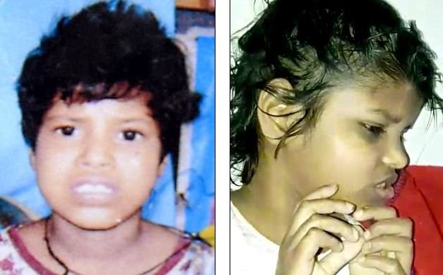 bocah india dibesarkan monyet
