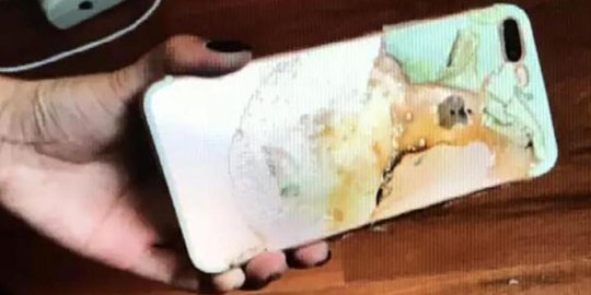 Baru beli sebulan, iPhone 7 Plus wanita ini terbakar tanpa sebab
