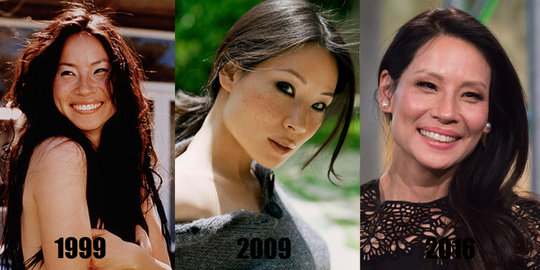 Akupunktur, rahasia awet muda si cantik Lucy Liu