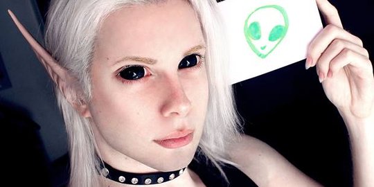 Pemuda ini nekat oplas demi penuhi obsesi jadi peri sejati
