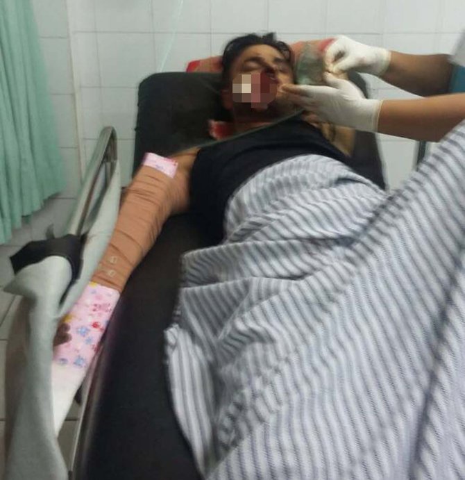 kecelakaan pajero di tol dalam kota