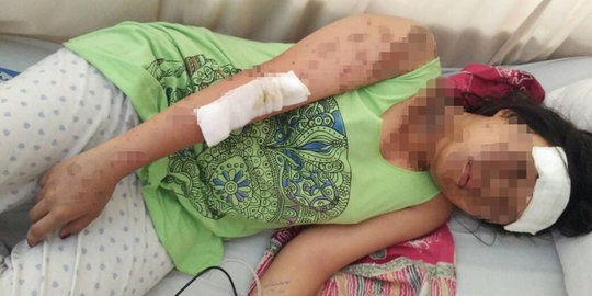 Polisi bekuk 6 dari 10 pelaku penyiraman air keras di Klender