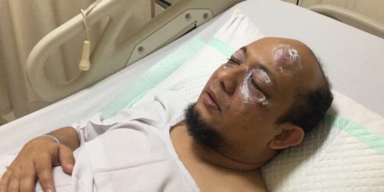 Fadli Zon minta terduga penyiram Novel segera diproses hukum