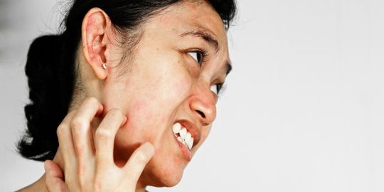 ini akibatnya jika kamu kebanyakan makan mangga [part 2]