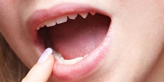 ini akibatnya jika kamu kebanyakan makan mangga [part 2]