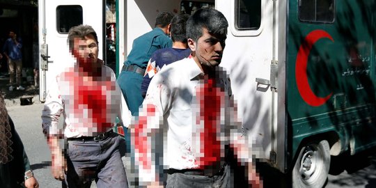 Mengerikan, korban bom Afghanistan berubah jadi 'zombie'
