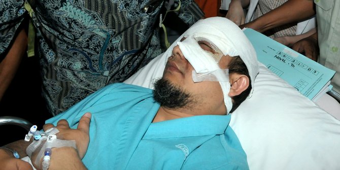 Dokter lepas membran dan lensa kontak di mata kiri Novel 