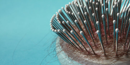 Kekurangan yodium ternyata bisa bikin rambut rontok