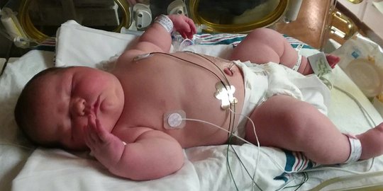 Pecahkan rekor, ibu di AS lahirkan bayi seberat 6 kilogram