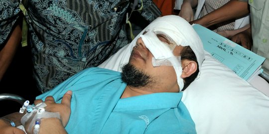 KPK: Mata kanan Novel sudah mulai bisa melihat