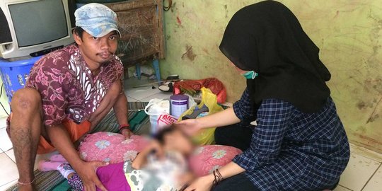 Bocah 8 tahun penderita Hidrosefalus di Citayam butuh uluran tangan