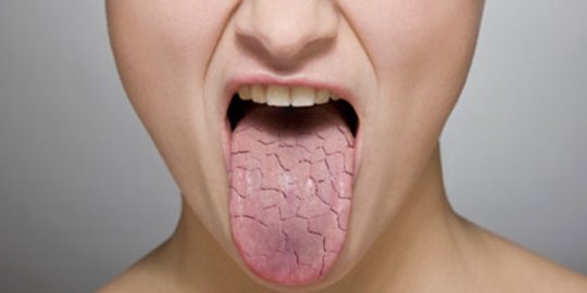 6 Penyebab kenapa mulutmu tak produksi air liur secara normal