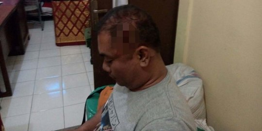 Asyik nongkrong di warung, anggota TNI diserang 3 pemuda di Buleleng