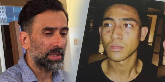 Sempat protes keras, kini Jeremy Thomas serahkan Axel hadapi hukum