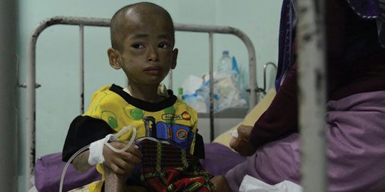 Bocah yatim piatu usia 6 tahun di Bekasi alami gizi buruk