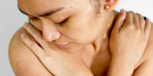 7 efek berbahaya saat kamu kebanyakan makan kayu manis