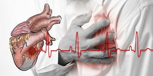 7 gejala ini muncul sebulan sebelum serangan jantung datang