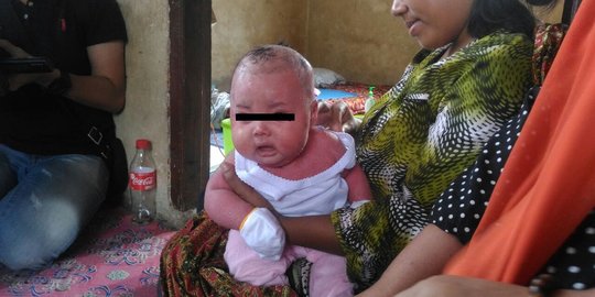 Kisah pilu bayi pengidap penyakit langka, BPJS ditolak karena telat daftar satu jam