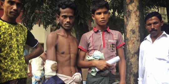 Rumah sakit Bangladesh kewalahan rawat warga Rohingya kena luka tembak, patah tulang