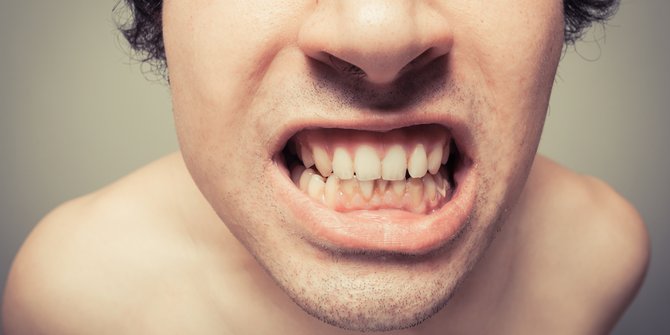 19 Cara memutihkan gigi secara alami