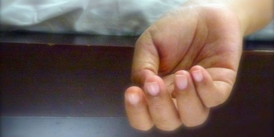 Diduga over dosis miras, anak punk ditemukan tewas bersandar di pagar