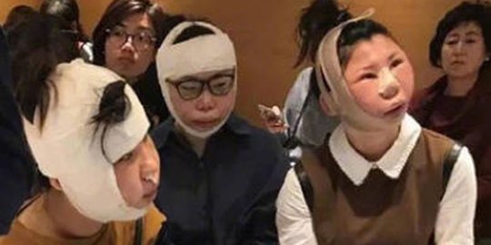 Operasi plastik, 3 wanita China ditahan di bandara sebab wajah beda dengan di paspor