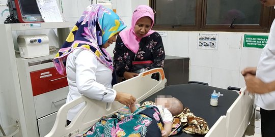 Bayi 4 bulan di Pekanbaru menderita tumor wajah