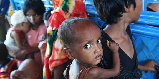 Ribuan anak-anak pengungsi Rohingya mengalami gizi buruk