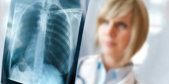Waspada, 5 gejala tak biasa dari penyakit kanker paru paru