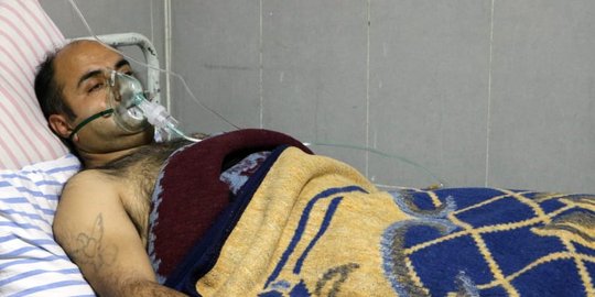 Turki dituding pakai senjata kimia melawan pasukan Kurdi di Suriah