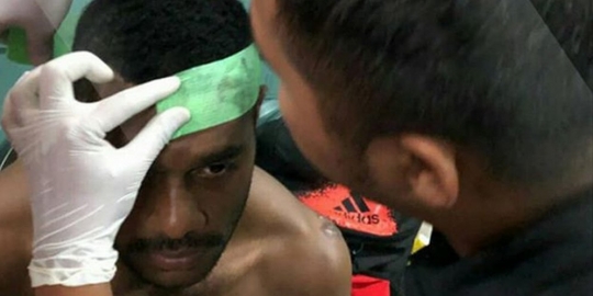 Pemain Sriwijaya FC ini jadi korban pemukulan Panitia Piala Gubernur Kaltim 2018