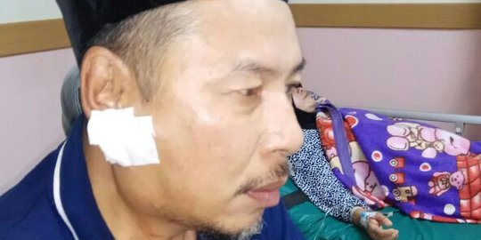 Jadi korban penyerangan orang gila, Abdul Rochman kini sering was-was