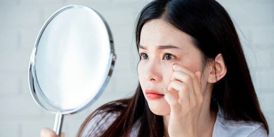 5 Pemahaman Salah Kaprah tentang Purging saat Coba Produk Skincare