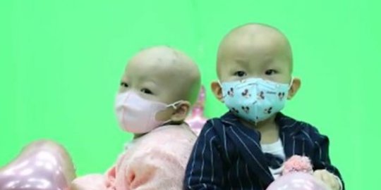 bocah dua tahun di china sudah menikah rev1