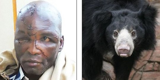 selamat setelah dicabik cabik beruang rev2