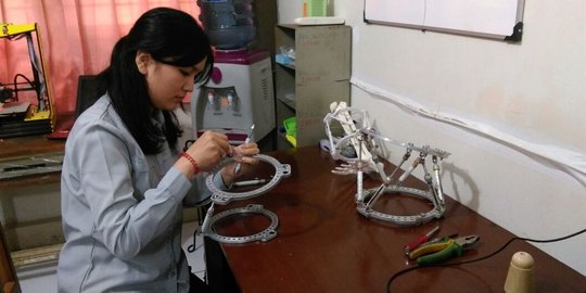 Mahasiswi UNS ciptakan alat canggih, bisa luruskan tulang bengkok dan patah