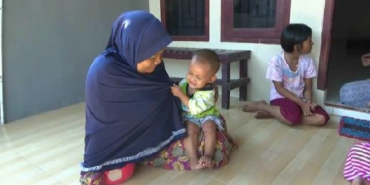 Penjelasan Dinkes soal wabah flu Singapura serang anak-anak Purwakarta