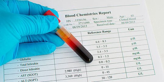 6 kemungkinan penyebab kulit tiba-tiba gatal, dari alergi sampai leukemia