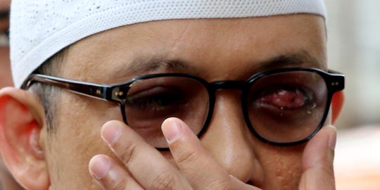 Prabowo-Sandiaga jamin keadilan bagi Novel Baswedan