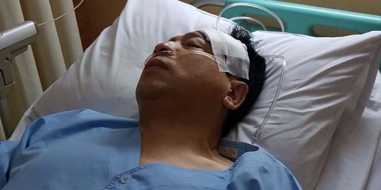 kepala setya novanto rev1