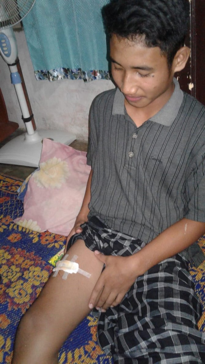 remaja di pekanbaru nyaris tewas diserang buaya