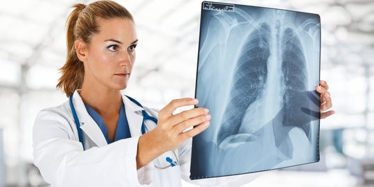 4 Hal yang perlu diwaspadai dari kanker paru-paru