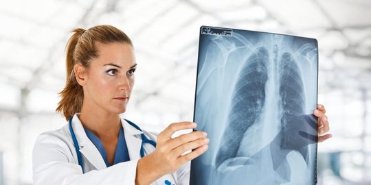 juga bisa terkena kanker paru rev1