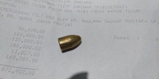 Diduga kena peluru nyasar, ibu rumah tangga di Makassar luka di payudara