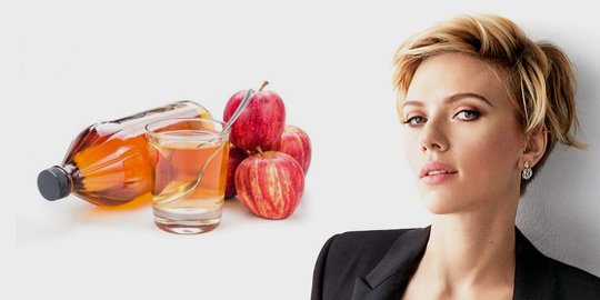 9 tips atasi jerawat parah ala selebriti dunia, bisa dipraktikkan di rumah