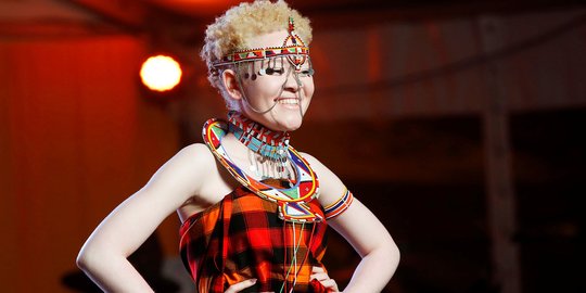 Saat Penderita Albino Kenya Berlenggok di Atas Catwalk