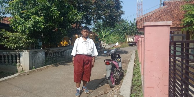 arya bocah obesitas asal karawang