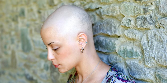 Penderita Kanker Bisa Sembuh Dan Tidak Boleh Ditakuti Dengan