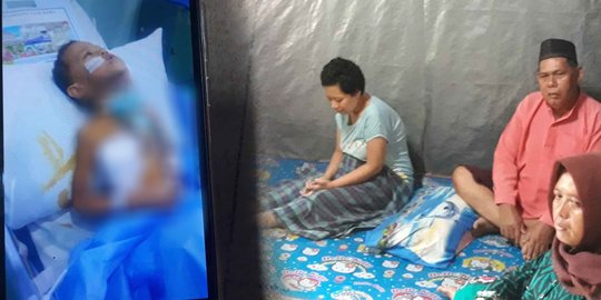 Kisah Pilu Ibu dan Anak di Serang Berjuang Melawan Tumor dalam Keterbatasan