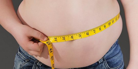 Seperti Titi Wati, Sunarti Derita Obesitas Berat Badan Capai 250 Kg